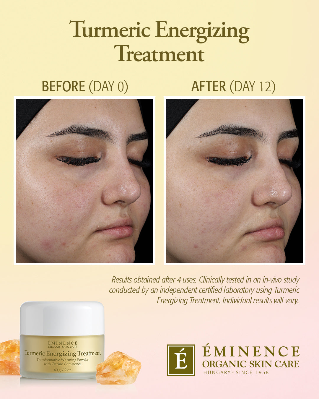 Turmeric Energizing Treatment