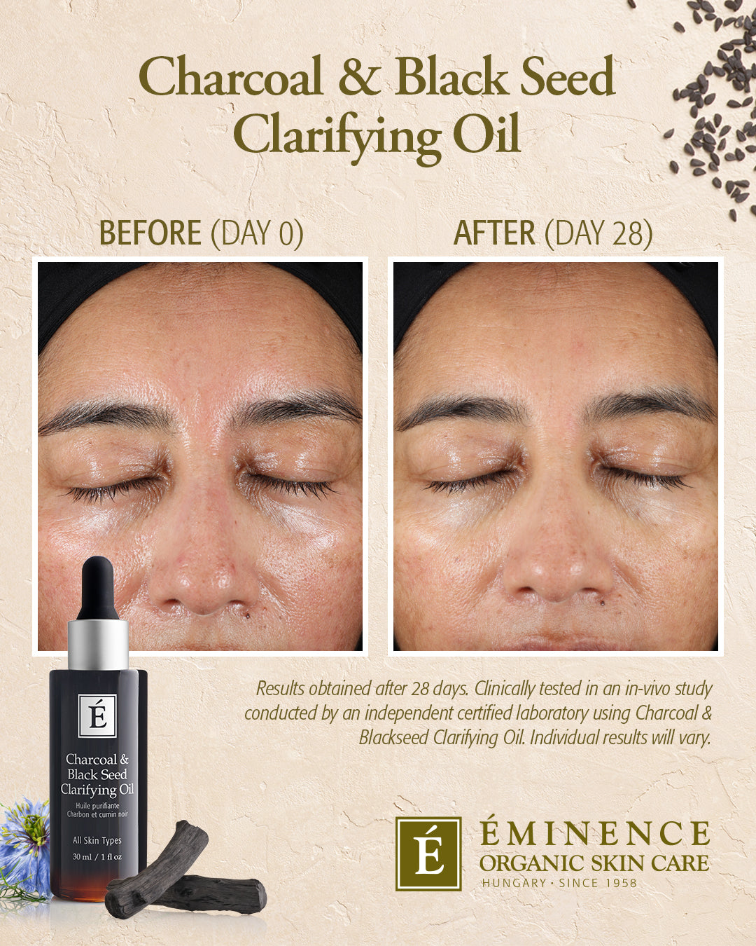 Charcoal & Black Seed Clarifying Oil