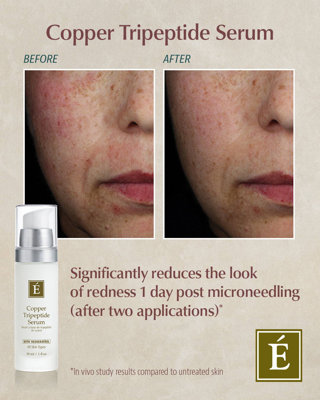 Copper Tripeptide Serum
