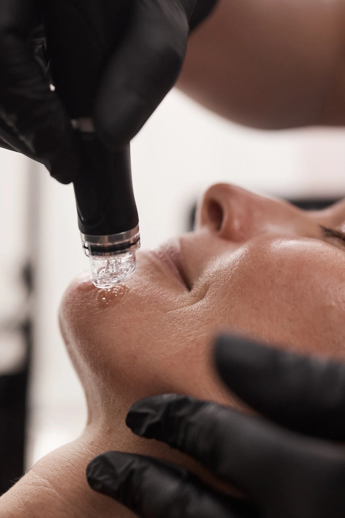 Four steps to visibly better skin.