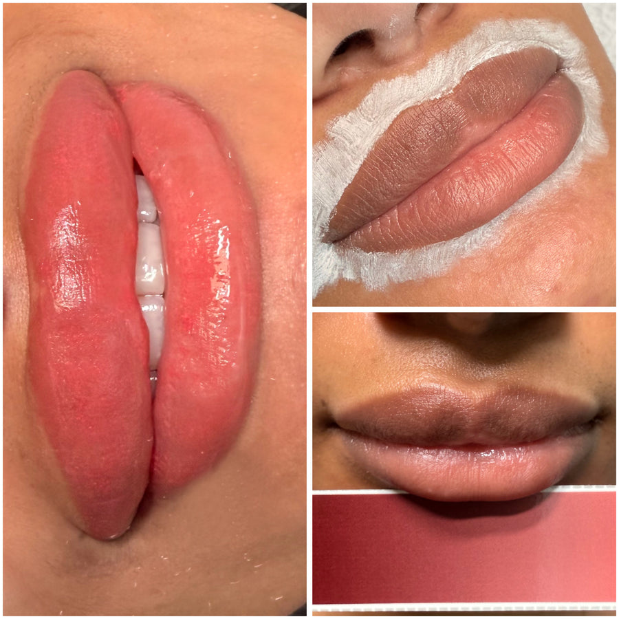 Dark Lip Neutralization